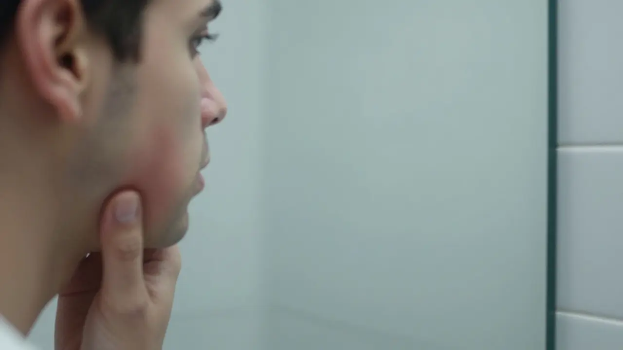 Osobní pohled do zrcadla ukazující viditelný otok tváře v důsledku abscesu.