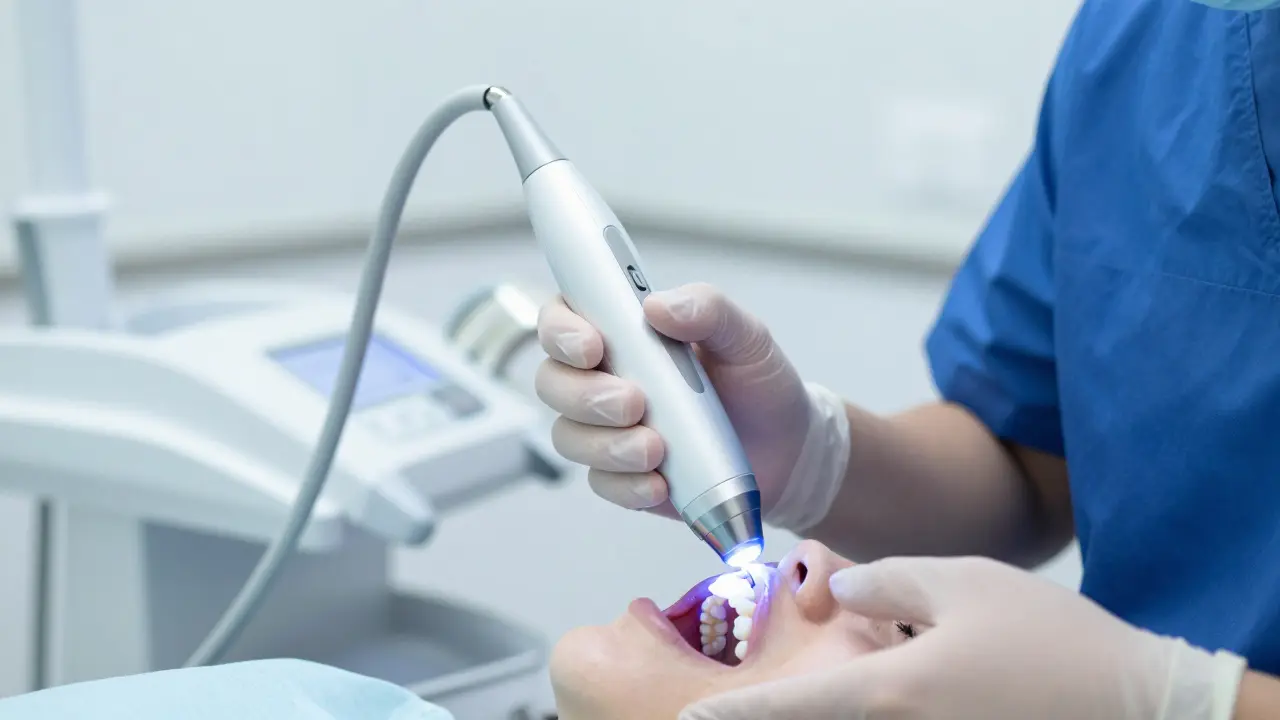 Jak dlouho trvá nalepení korunky? Kompletní průvodce procesem a časy